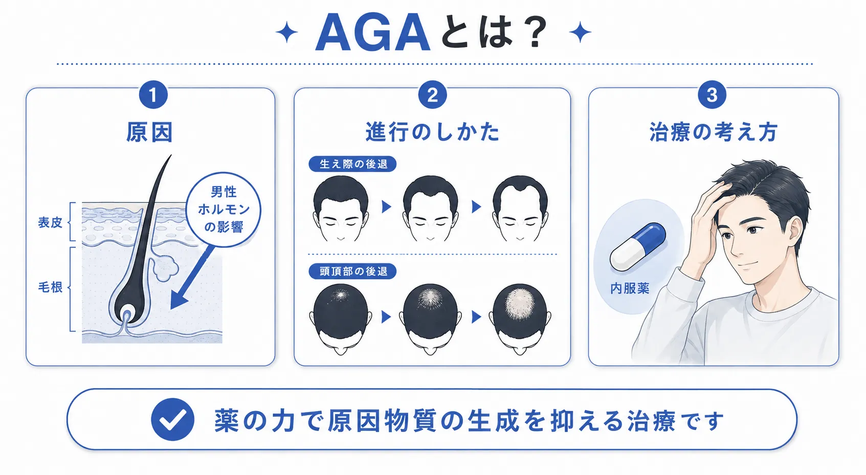 AGA(男性型脱毛症)とは