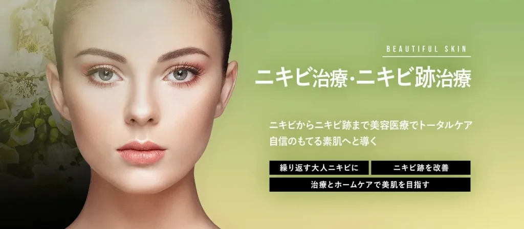TCB ニキビ治療