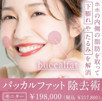 バッカルファット除去術