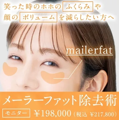 メーラーファット除去術