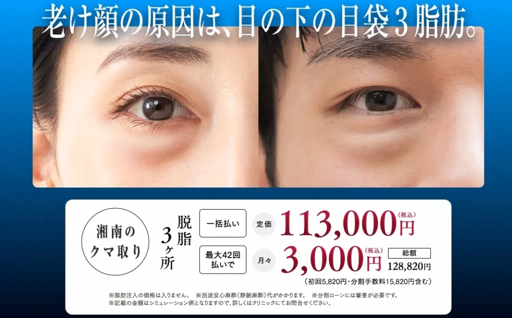 湘南の目の下の切らないクマ取り・たるみ(ふくらみ)取り