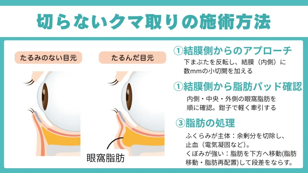 切らないクマ取りの施術方法の説明