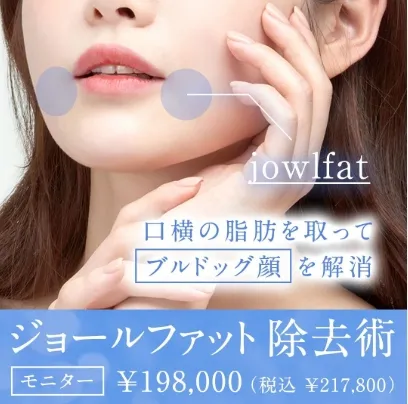 ジョールファット除去術