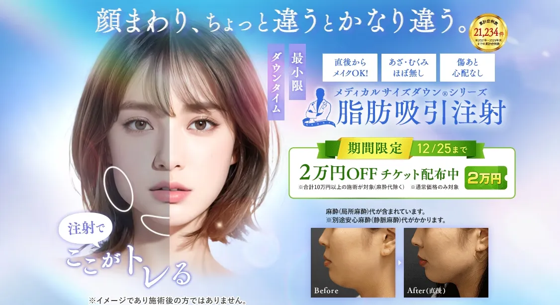 湘南脂肪吸引注射