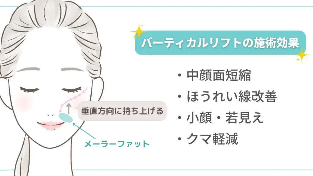 バーティカルリフトの施術効果