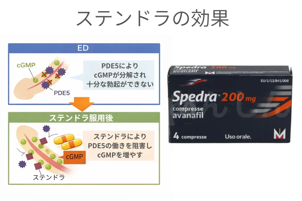 ステンドラの効果
