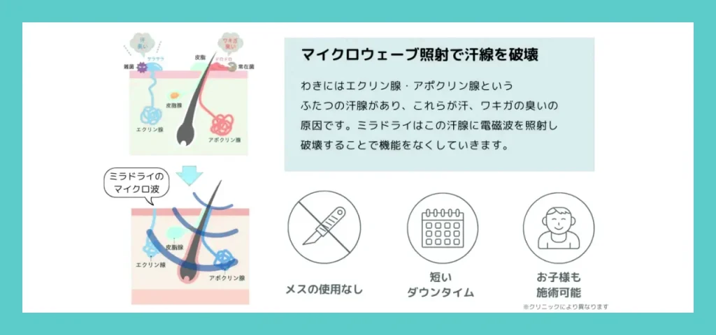 ミラドライの原理