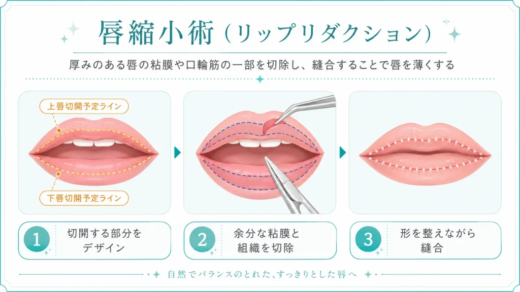 口唇縮小術の施術方法